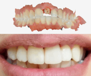 Intraoral Scanner - Prosthodontics scan view
